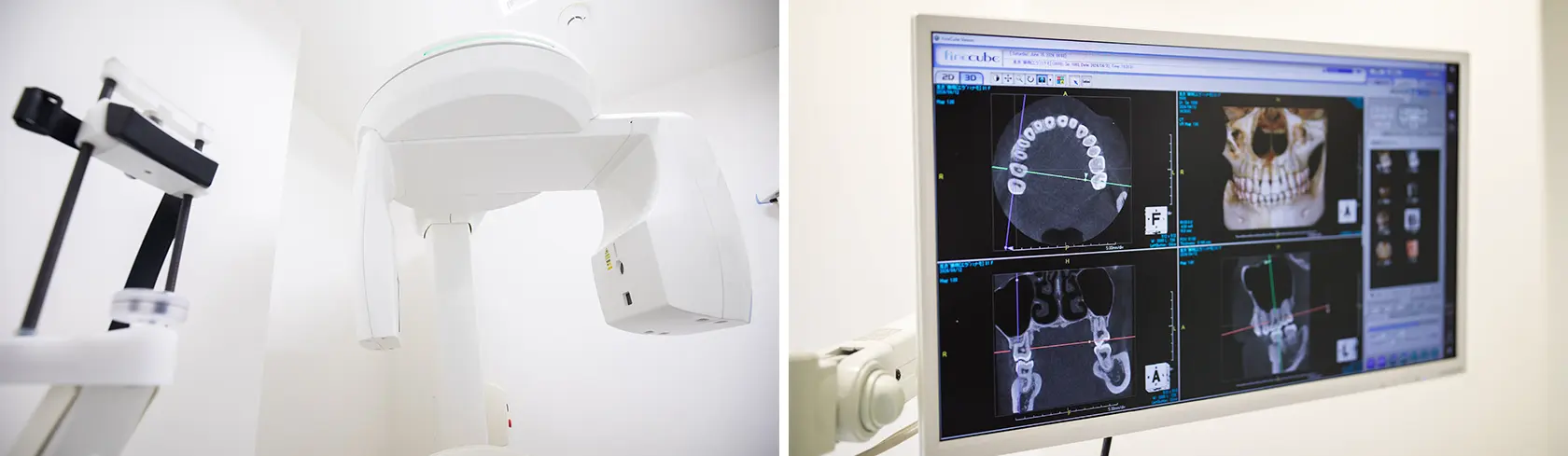 歯や顎の骨の情報を収集する歯科用CT