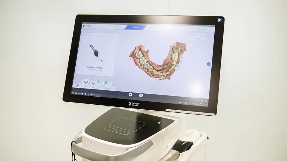 美しい治療を叶える口腔内スキャニングー