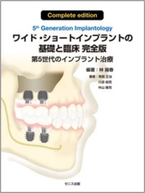 第５世代のインプラント治療